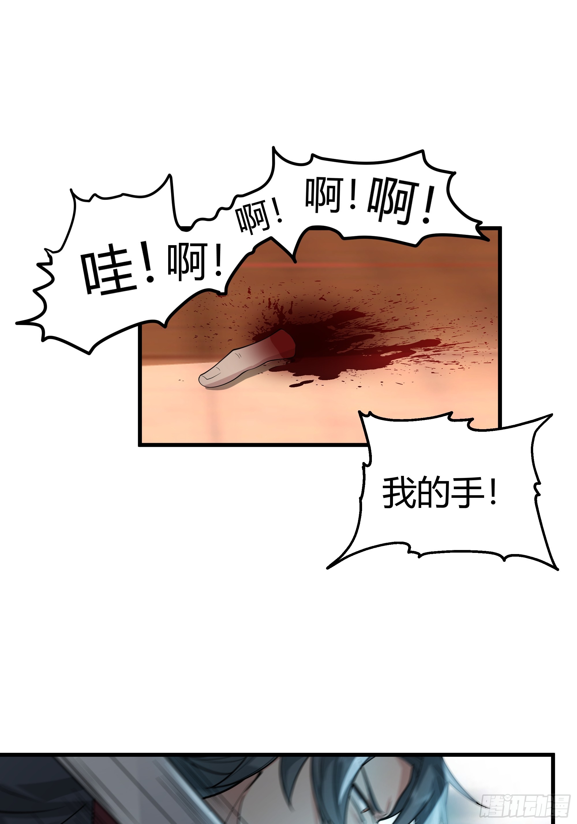 第14话-刀疤-第15话