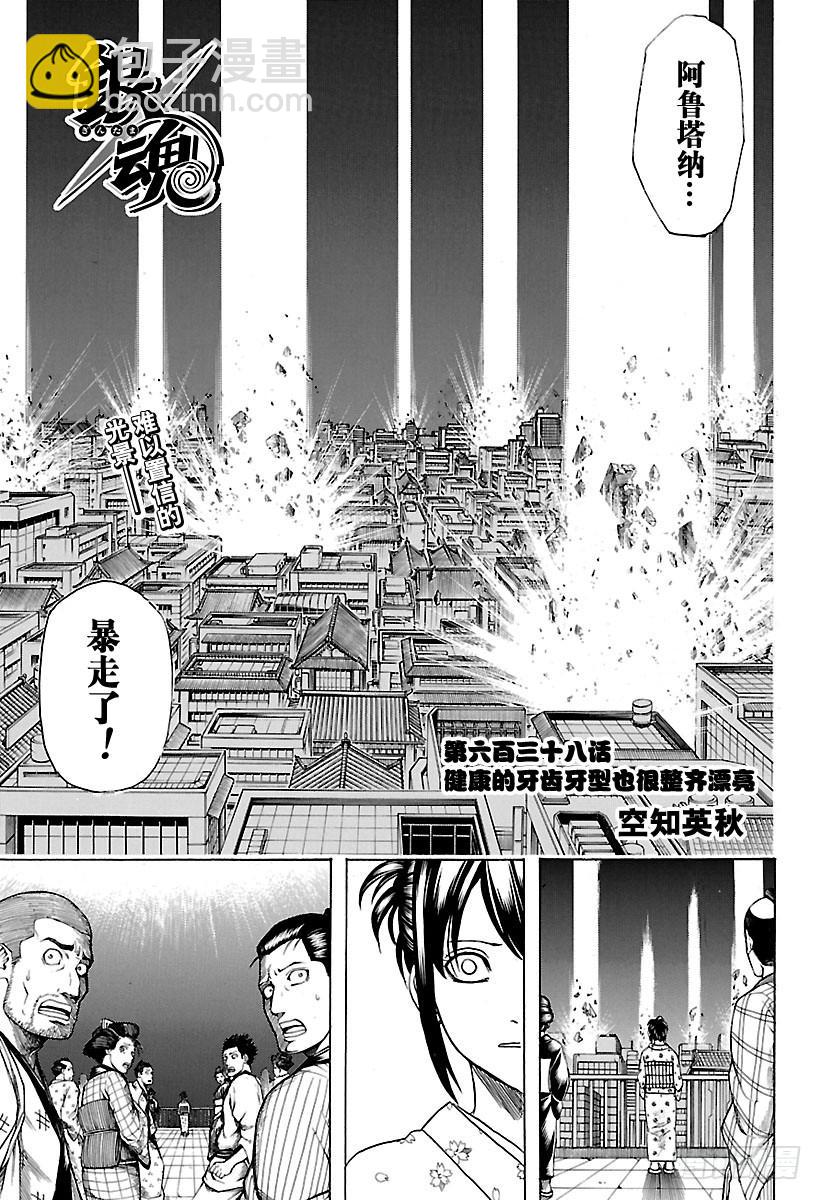🍜银魂 第638话 健康的牙齿牙型也很整 第5页