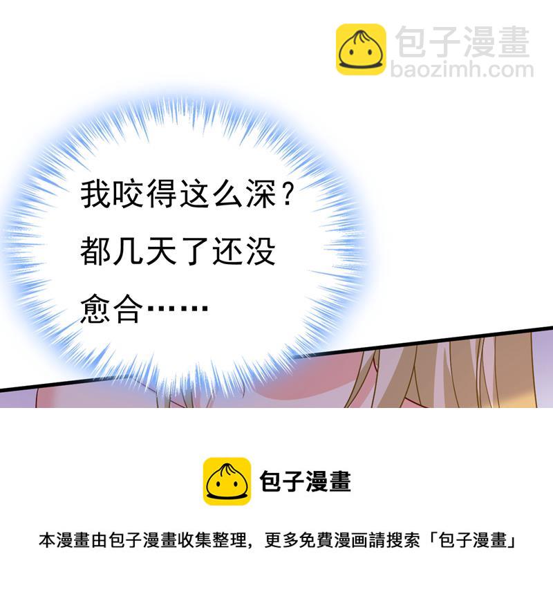 你的手怎么回事？(1/2)-第545话