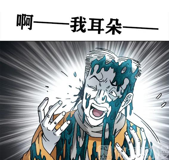 第219话   动手术-第219话