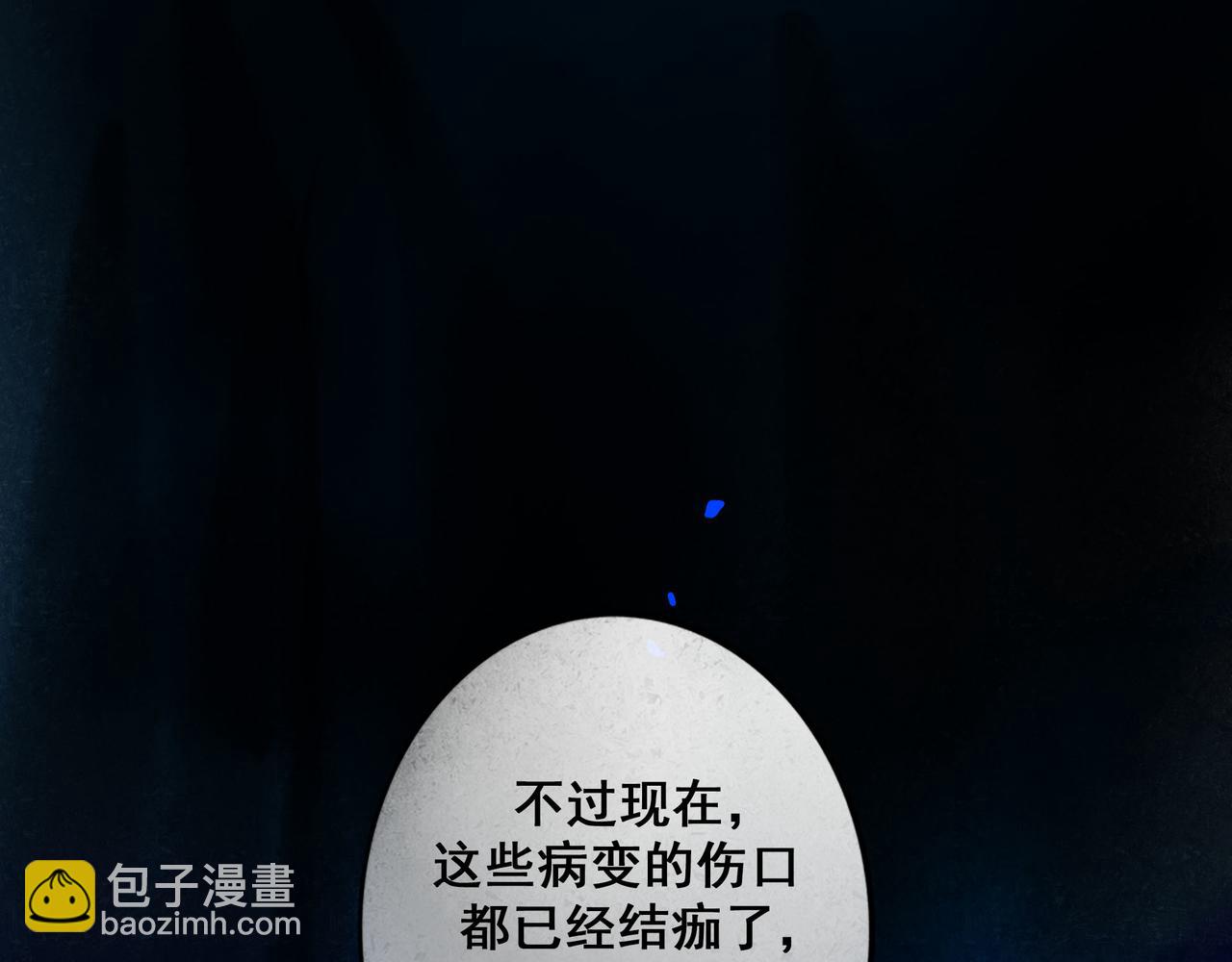 89.心上疤(1/2)-第91话